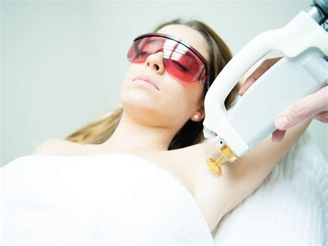 laser hair removal usa